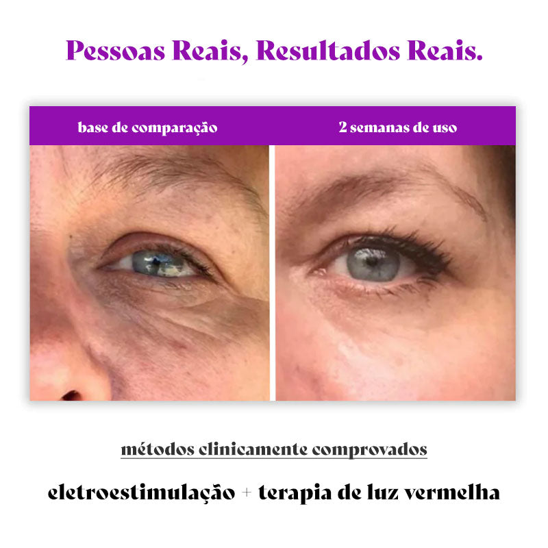 ReviPlus - Tratamento Clinicamente Comprovado Que Reduz Olheiras e Bolsas Em 2 Semanas